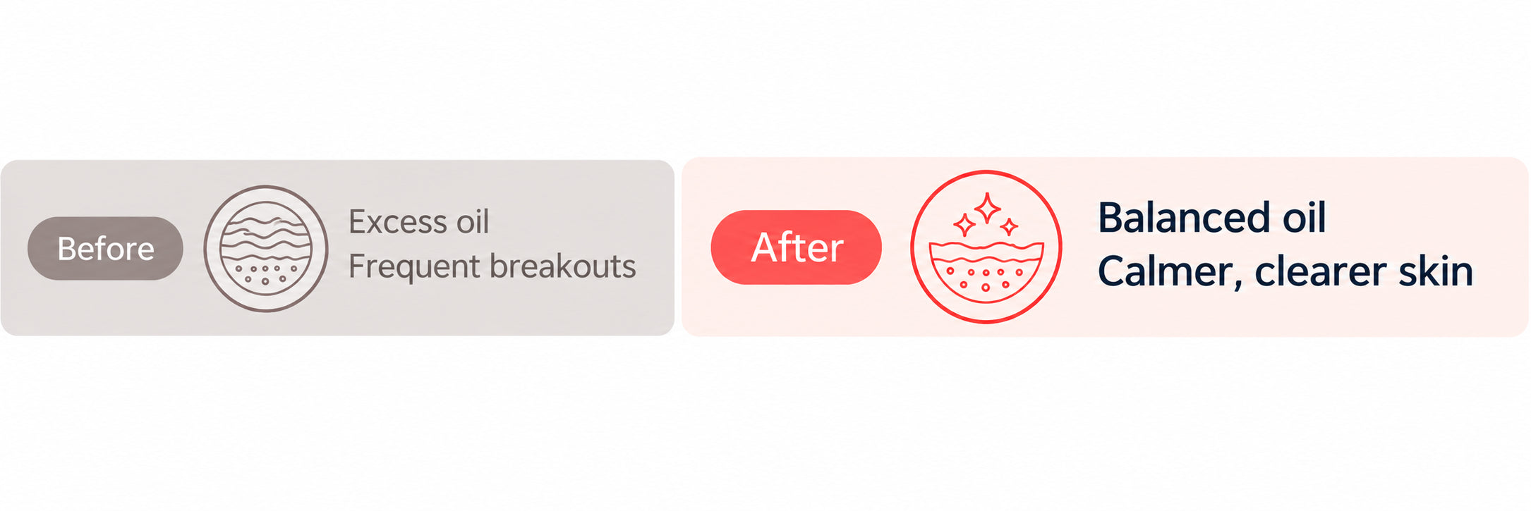 Before: excess oil and frequent breakouts. After: balanced oil, calmer and clearer skin.