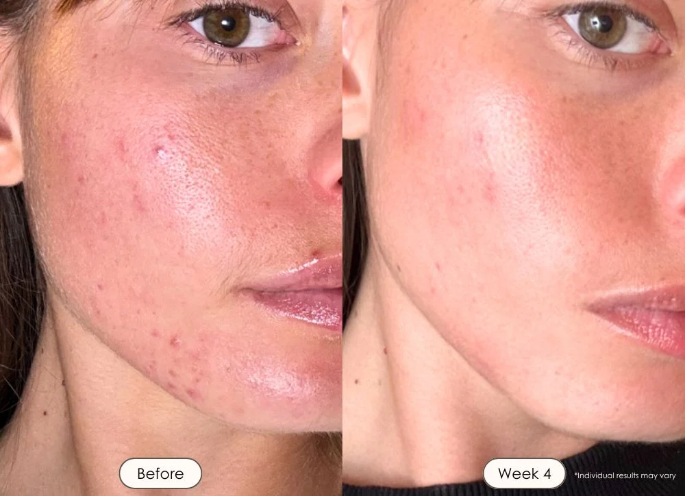 Ashley before and after